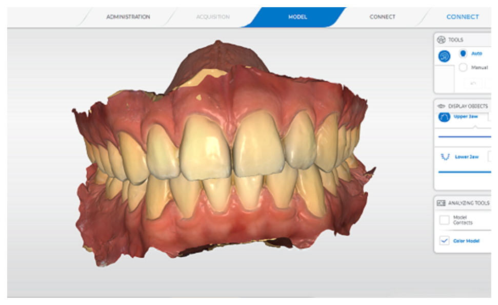 精密診断を快適に、口腔内スキャナー導入