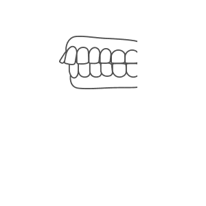 前歯が出ている（出っ歯）